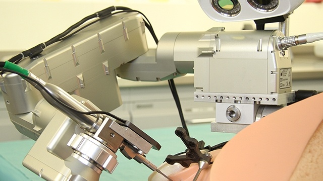 robotic human arm implantations
