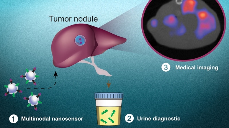 Noninvasive Test Detects Cancer Cells - Medical Design Briefs