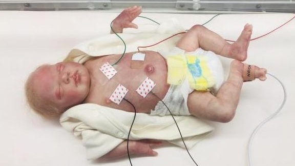 Patch Improves Care For NICU Babies - Medical Design Briefs