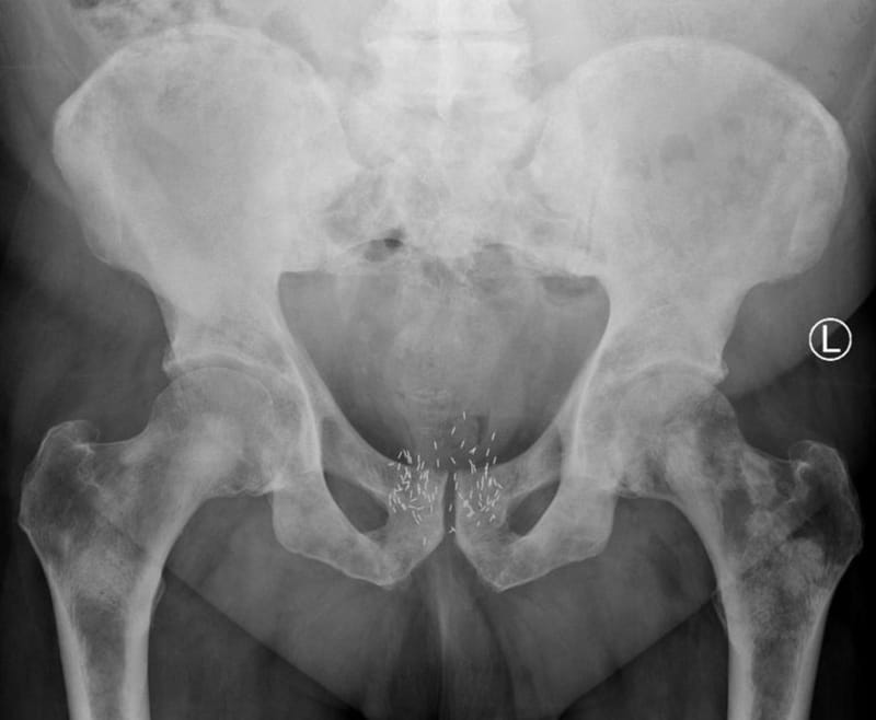 Image of an X-ray examination inviolving a new radical treatment solution.