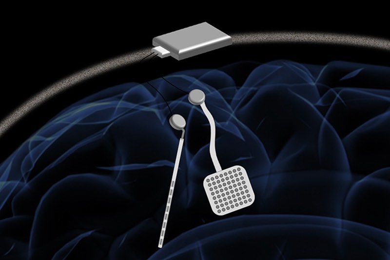 Image of new neurostimulator chips.