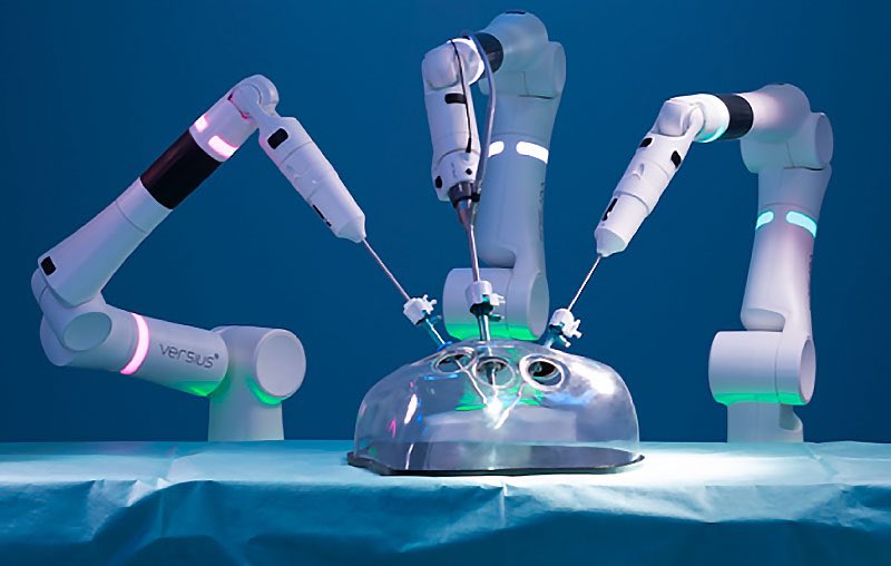 Photo of Versius, the next-generation surgical robot