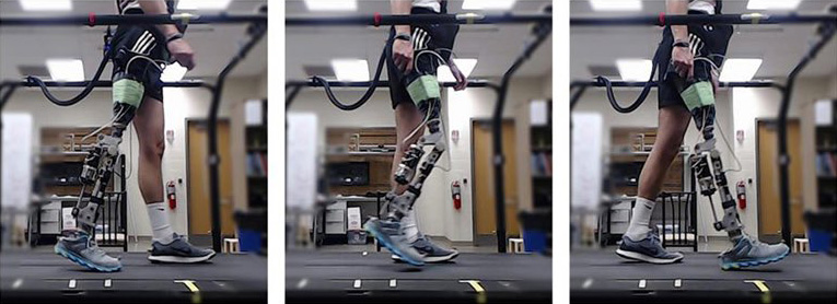 Photo of Prosthetic Knees.