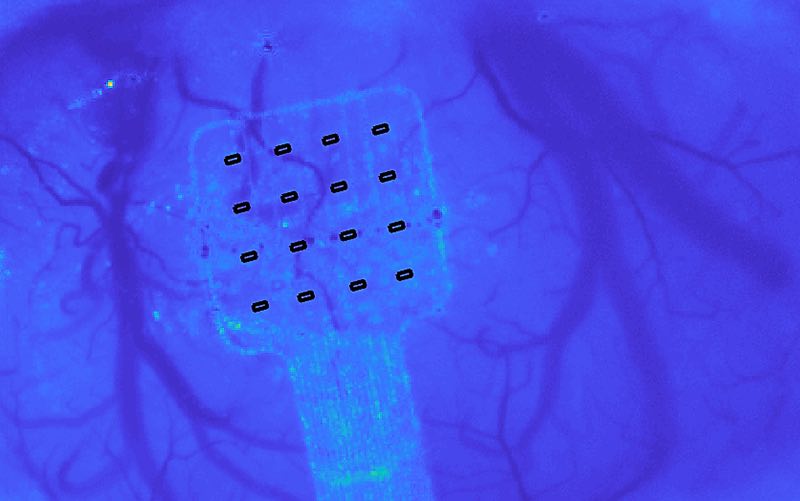 Image of Graphene Flagship's Brain Sensor.