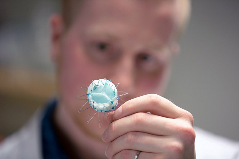 Image of Durable Heart Valve.