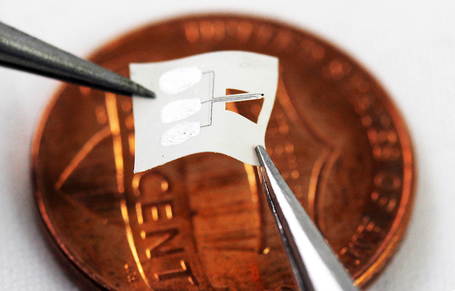 Image of Implantable Sensor.